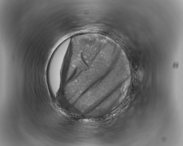 X0000098170100200805221524