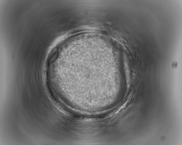 X0000098170149200805221523