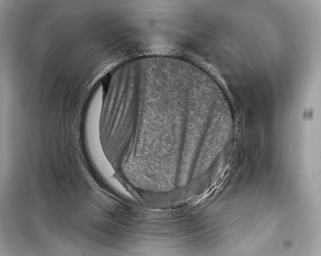 X0000098170154200805221523