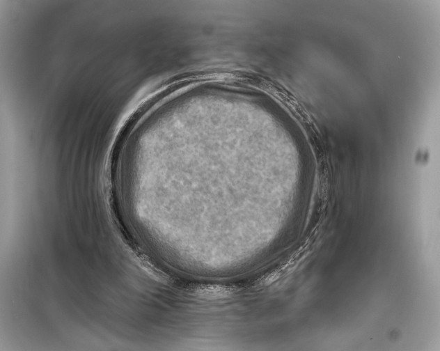 X0000098170198200805221522