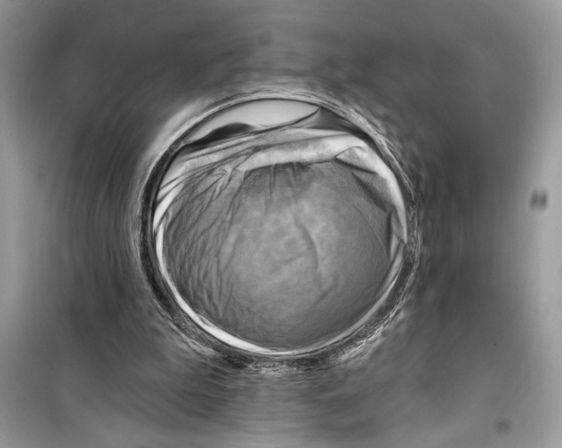 X0000098170199200805221522