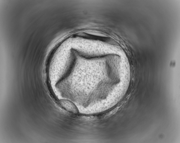 X0000098170245200805221521