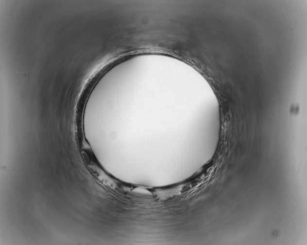 X0000098170248200805221521