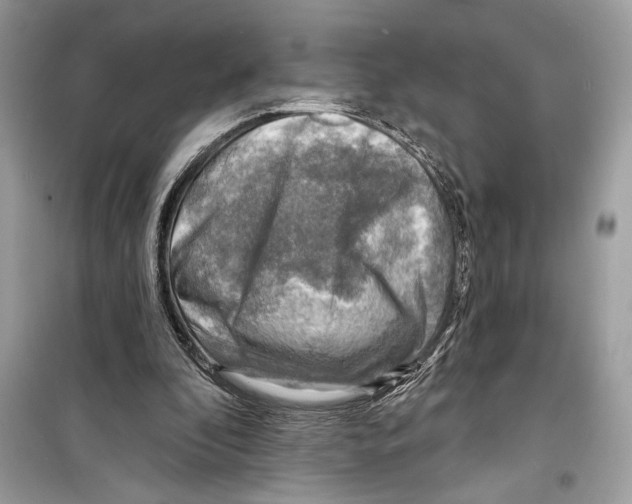 X0000098170296200805221521