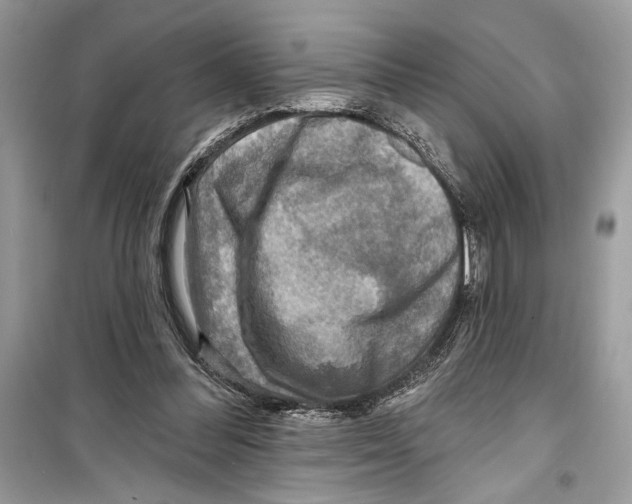 X0000098170300200805221521