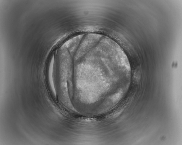 X0000098170304200805221521