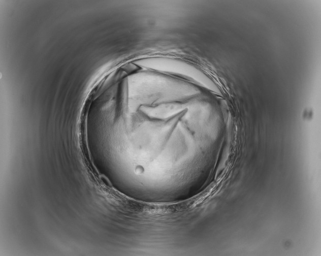 X0000098170340200805221520