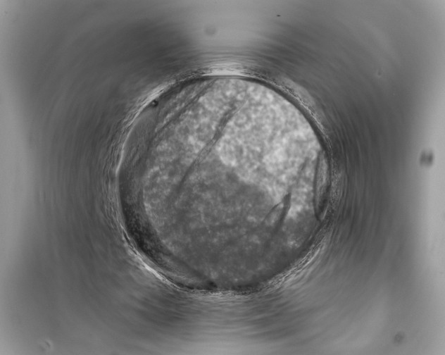 X0000098170385200805221520