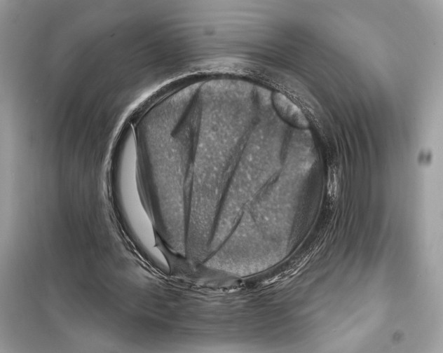 X0000098170388200805221520