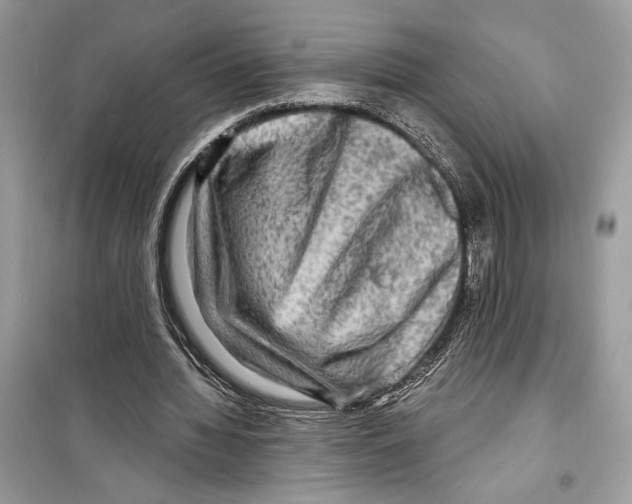 X0000098170436200805221518