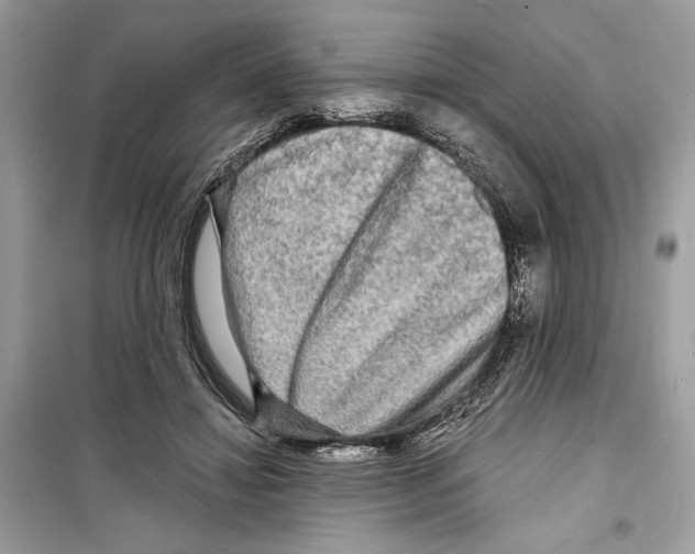 X0000098170452200805221519