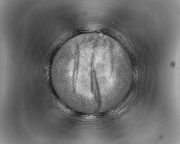 X0000098170462200805221519