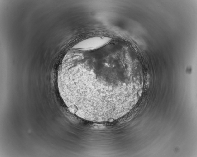 X0000098170519200805221518