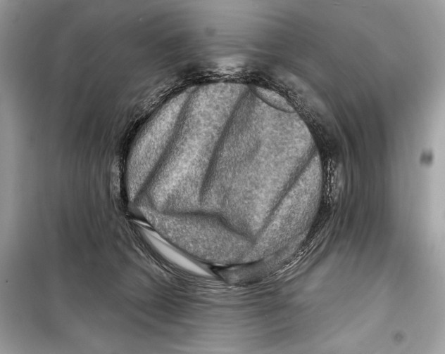 X0000098170562200805221517