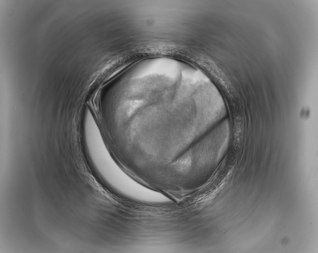 X0000098170585200805221517