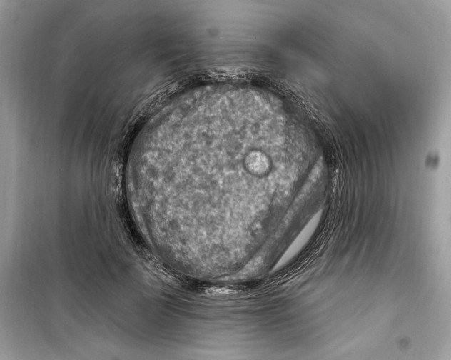 X0000098170699200805221515