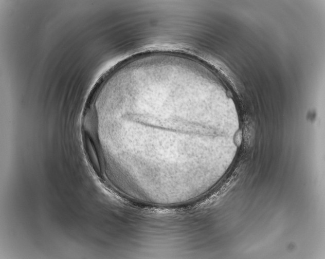 X0000098171030200805221511