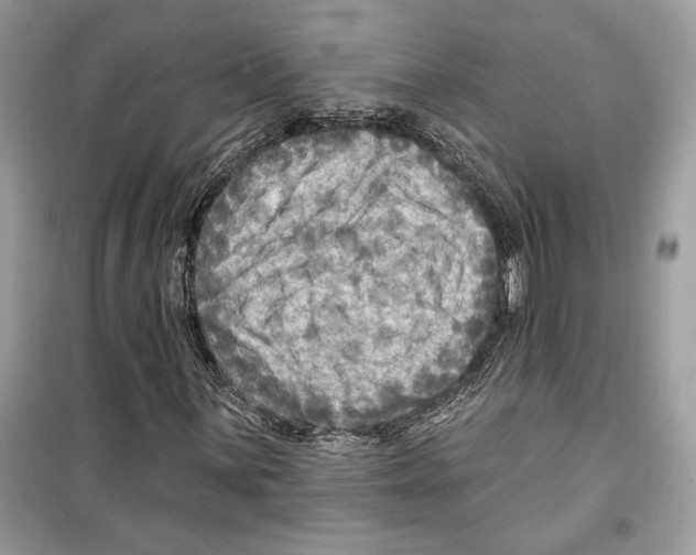 X0000098171059200805221510