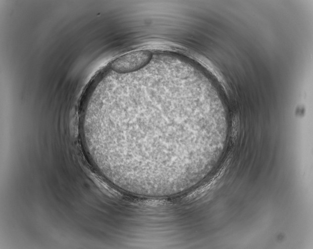 X0000098171067200805221510