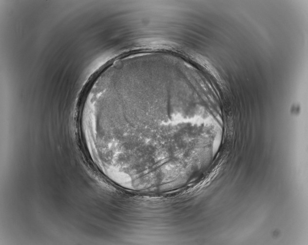 X0000098171071200805221510