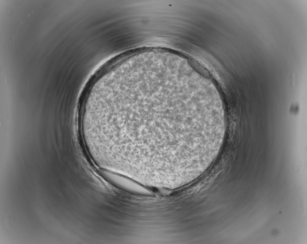 X0000098171076200805221510