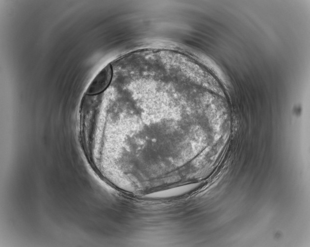 X0000098171095200805221510