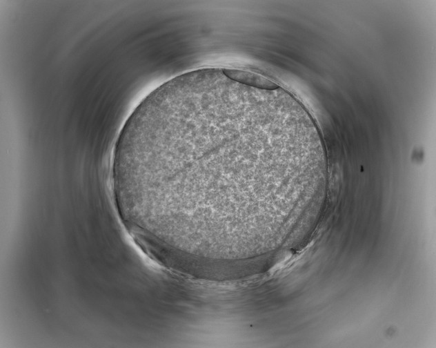 X0000098171103200805221510