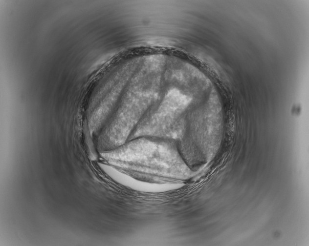 X0000098171110200805221509