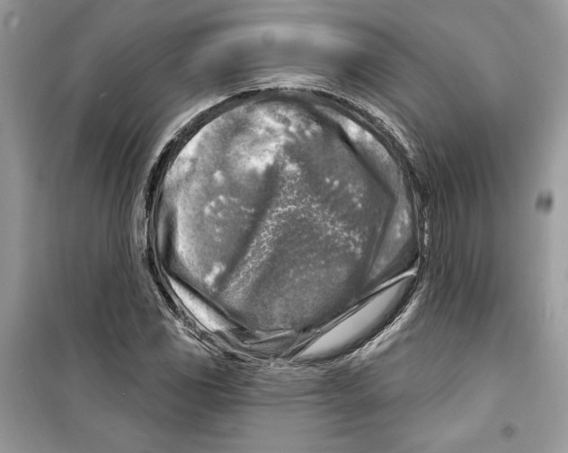 X0000098171117200805221509