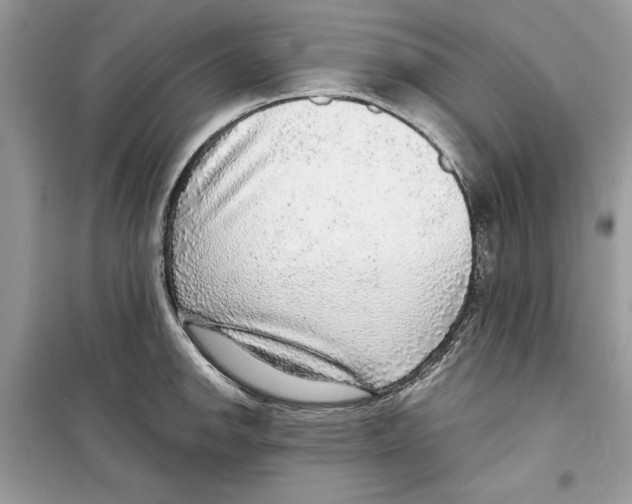 X0000098171142200805221510