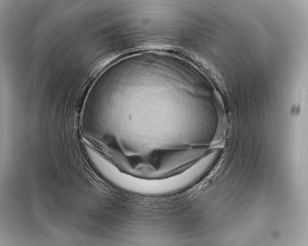 X0000098171169200805221509