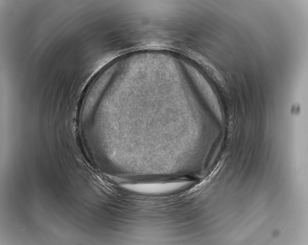 X0000098171170200805221509