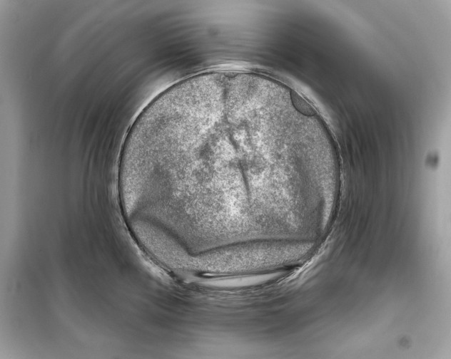 X0000098171194200805221509