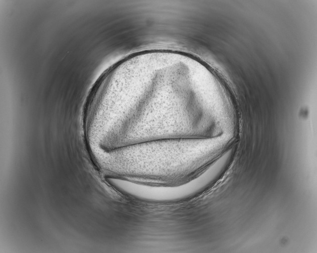 X0000098171230200805221508