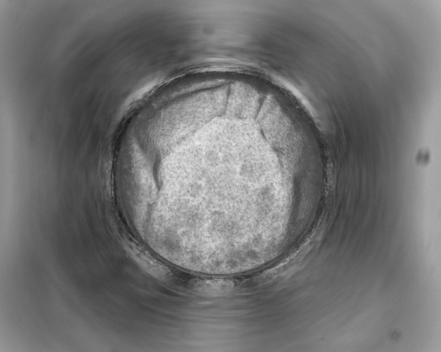 X0000098171403200805221505