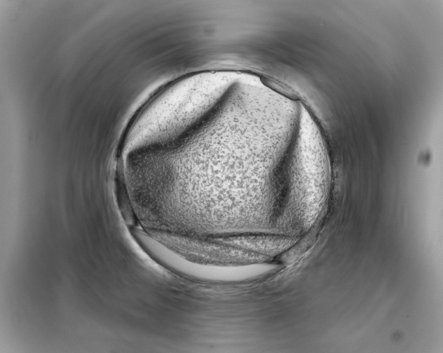 X0000098171476200805221504