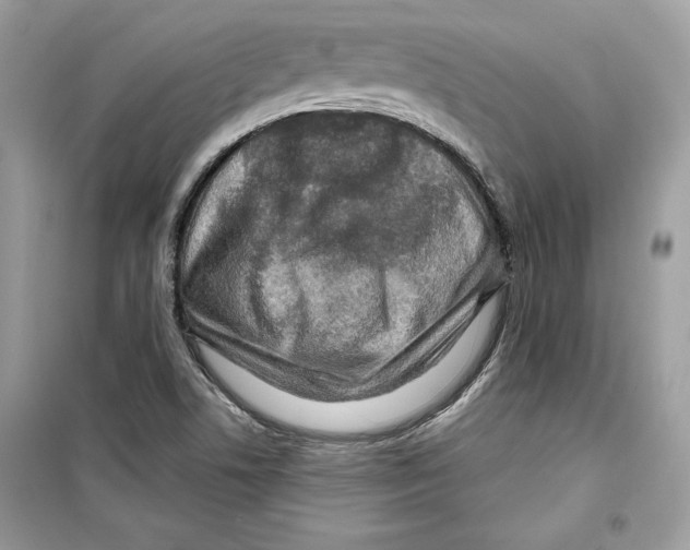 X0000098171506200805221504