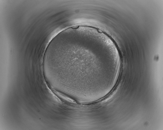 X0000098171529200805221504