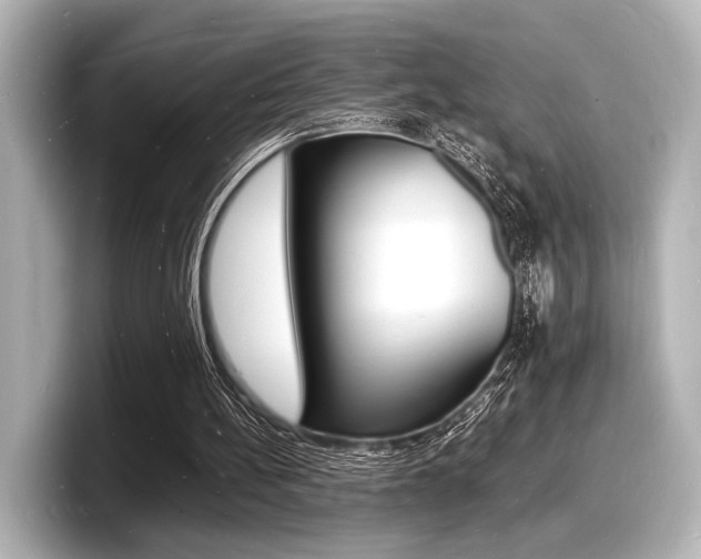X0000098180148200804241037
