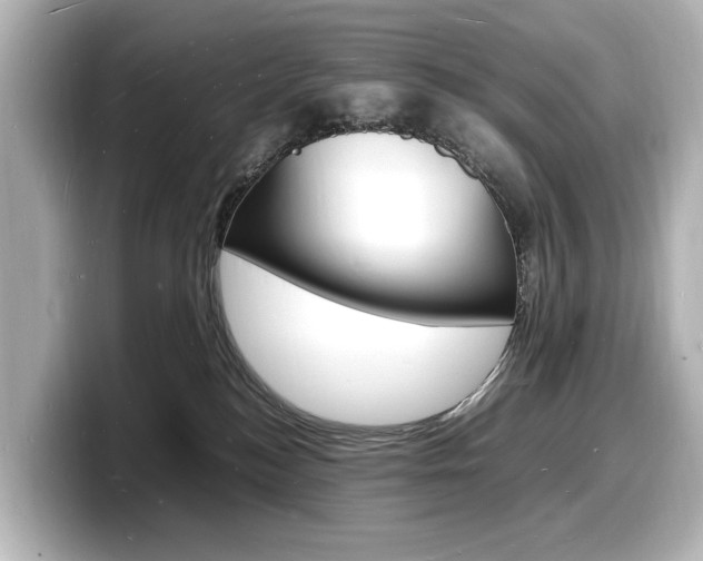 X0000098180184200804241038
