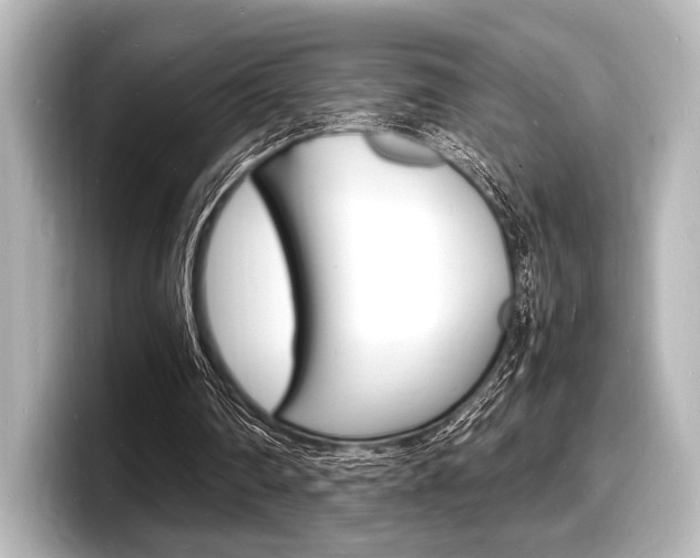 X0000098180290200804241036