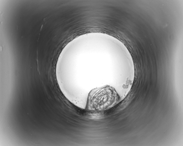 X0000098180370200804241035