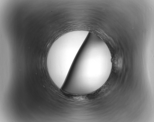X0000098180516200804241033