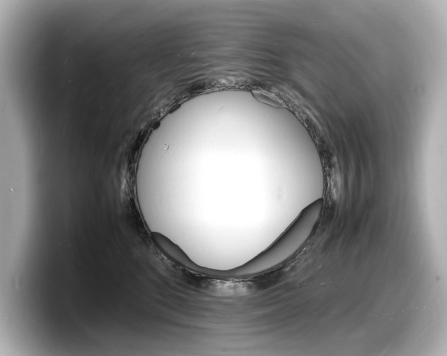 X0000098180520200804241033