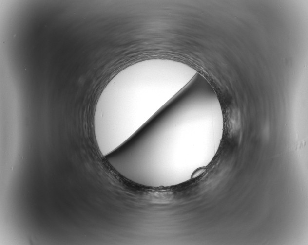 X0000098180619200804241031