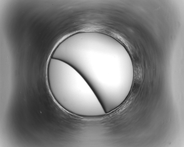 X0000098181487200804241020