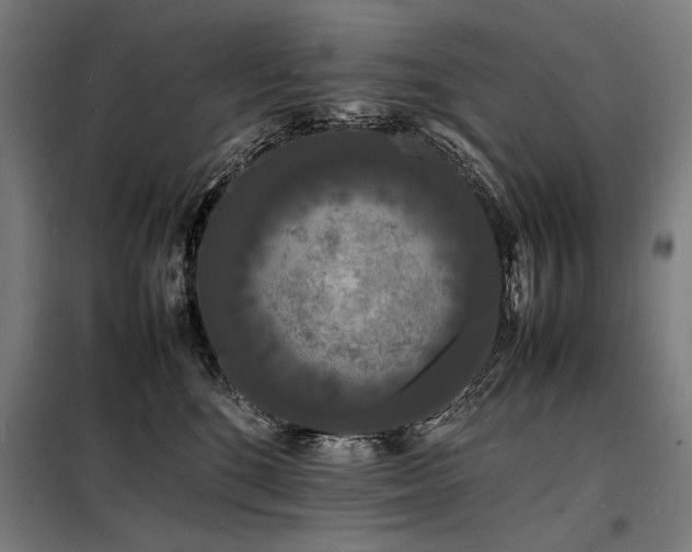 X0000098180520200804241224