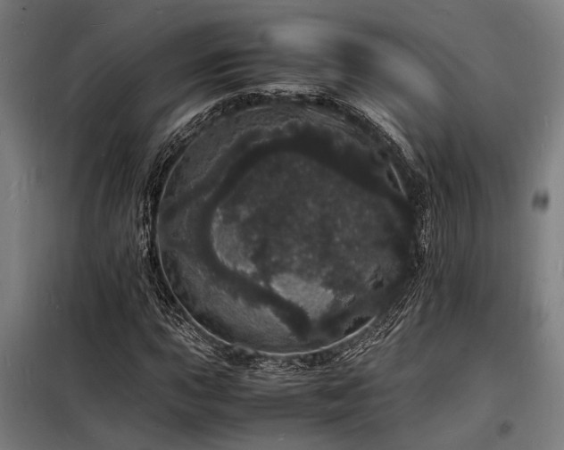 X0000098181015200804241216
