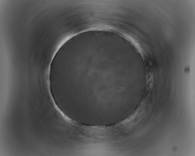 X0000098181103200804241216