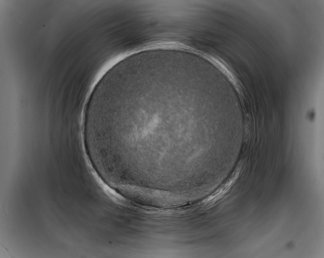 X0000098181438200804241211